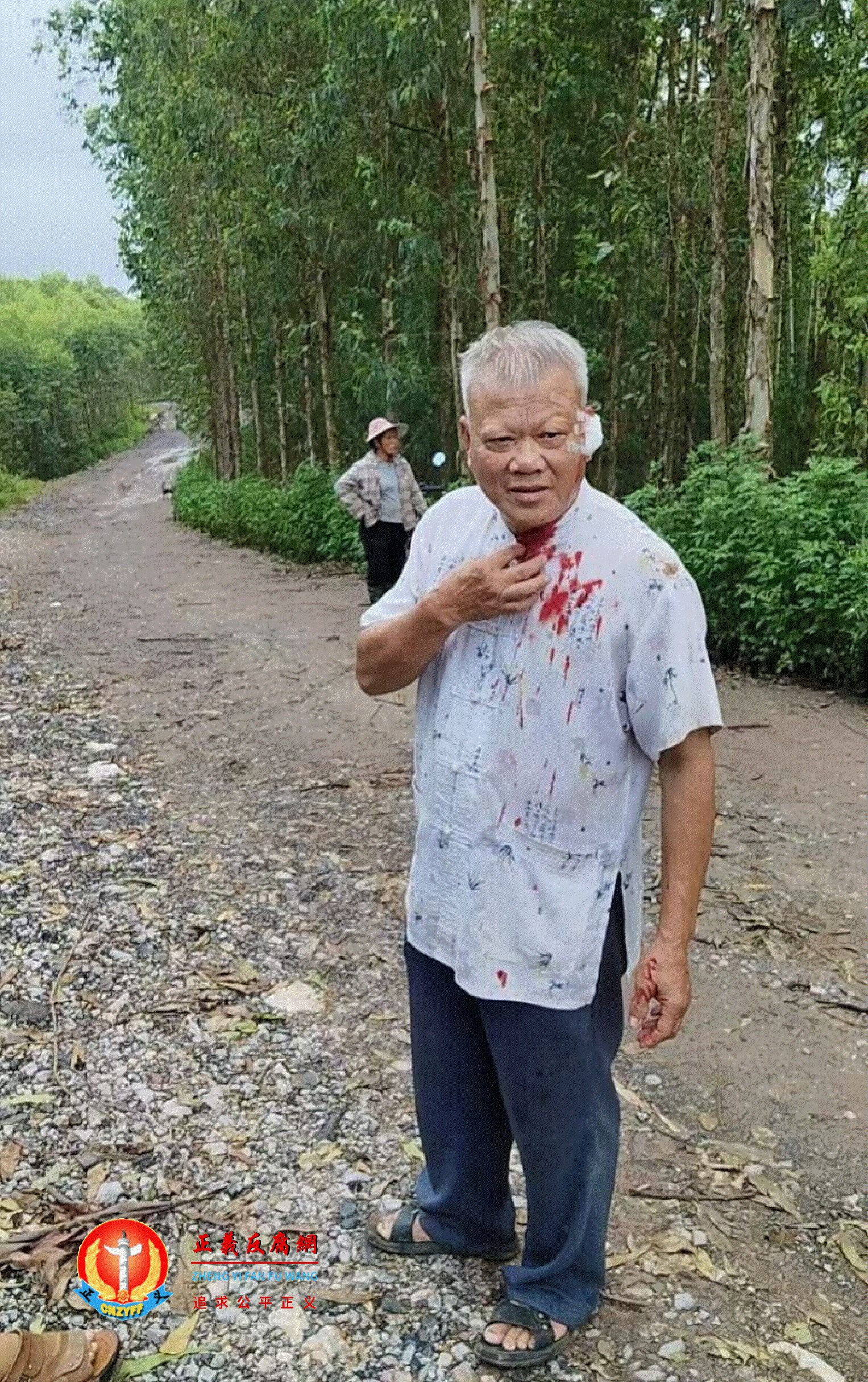 广西南宁市邕宁区百济镇华达村受伤村民。.gif 广西南宁市邕宁区百济镇华达村受伤村民。.gif